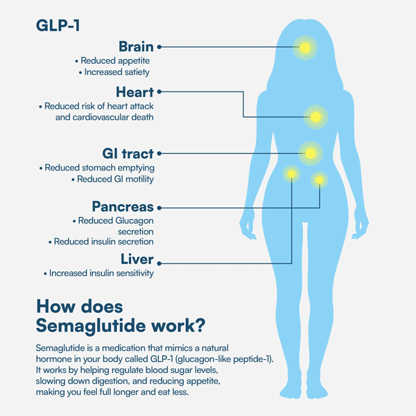 Body Diagram
